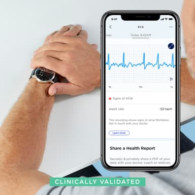 Withings ScanWatch hybrid smartklokke 42 mm (hvit)