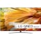 LG 65" QNED91 4K Mini-LED TV (2021)