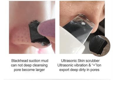 Ansiktsrens for peeling med ultralydvibrasjon Hvit