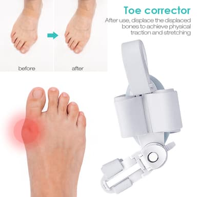 Tåseparator - Korrigerende støtte for Hallux Valgus Hvit