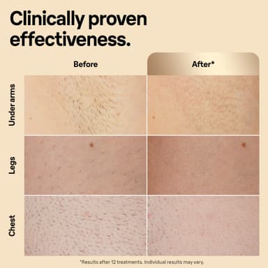 Braun IPL Silk-Expert Pro 5 hårfjernerlys PL5356