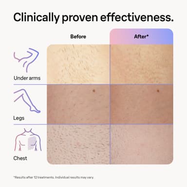 Braun Smart IPL Skin i-Expert Pro 7 hårfjernerlys PL7249