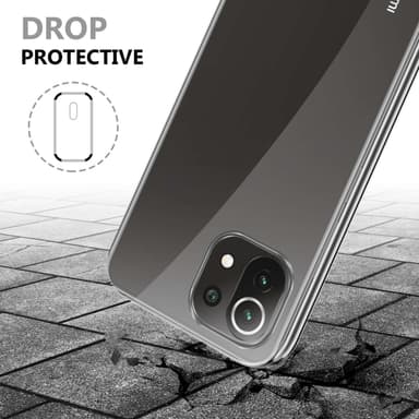 Xiaomi Mi 11 LITE (4G / 5G) / 11 LITE NE Deksel 360
