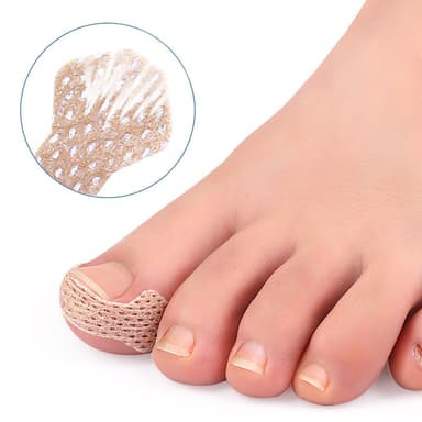 Gips for inngrodde tånegler Beige