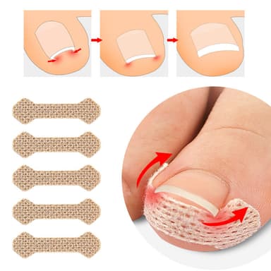 Gips for inngrodde tånegler Beige