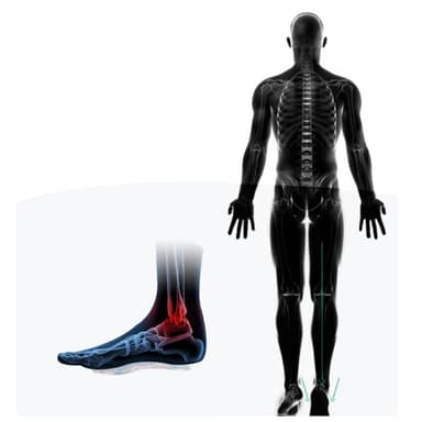 Innersåle Flat Foot Support Innleggssåler med høy hæl smertelindring - S