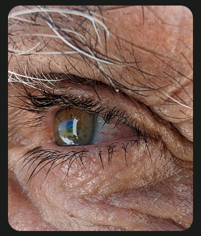 Close-up of an eye